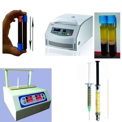 6/8x15ml เครื่องพกพา PRP Centrifuge 0-4000rpm สําหรับโรงพยาบาลศัลยกรรมเสริมสวย