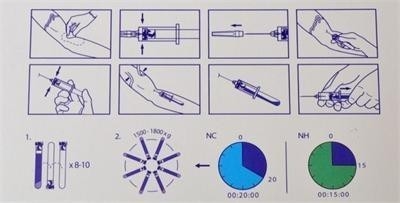 6/8x15ml เครื่องพกพา PRP Centrifuge 0-4000rpm สําหรับโรงพยาบาลศัลยกรรมเสริมสวย