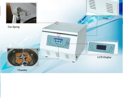 6000r/Min เซ็นทริฟิวเจอร์ทางการแพทย์ความเร็วสูง พร้อมการควบคุมไมโครโปรเซสเซอร์